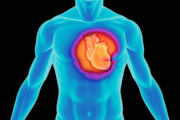 La mayoría de ataques cardíacos ocurre por la acumulación de placa en las arterias durante el transcurso de la vida, lo que provoca una obstrucción y un ataque cardíaco